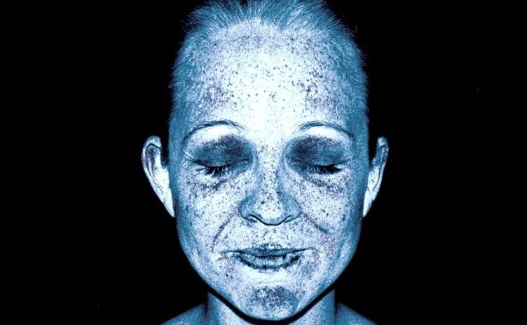 SunSense ambassador Carrie Bickmore's SunSensiblity UV skin analysis from the SunSense UV Photobus. SunSense ambassador Carrie Bickmore's SunSensiblity UV skin analysis from the SunSense UV Photobus.